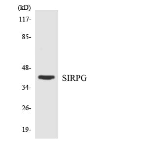 Polyclonal Rabbit anti-Human SIRPG Antibody (aa84-133, WB)