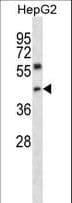 Polyclonal Rabbit anti-Human NFYC Antibody (aa100-129, WB)
