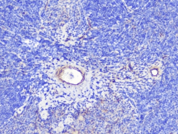 INPPL1 / SHIP2 Antibody