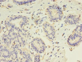 RAD17 Antibody (aa1-270)
