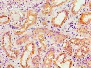 ACTR3B / ARP4 Antibody (aa189-418)
