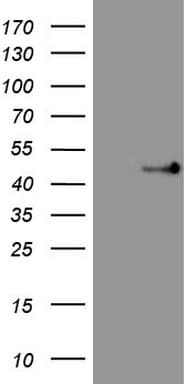 Monoclonal Mouse anti-Human TRB3 / TRIB3 Antibody (clone OTI3G4, Carrier-free, aa1-200, IHC, WB)