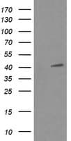MAPK13 / p38delta Antibody (clone OTI2A10)