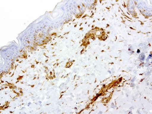 Vimentin Antibody (clone UMAB160, Carrier-free)