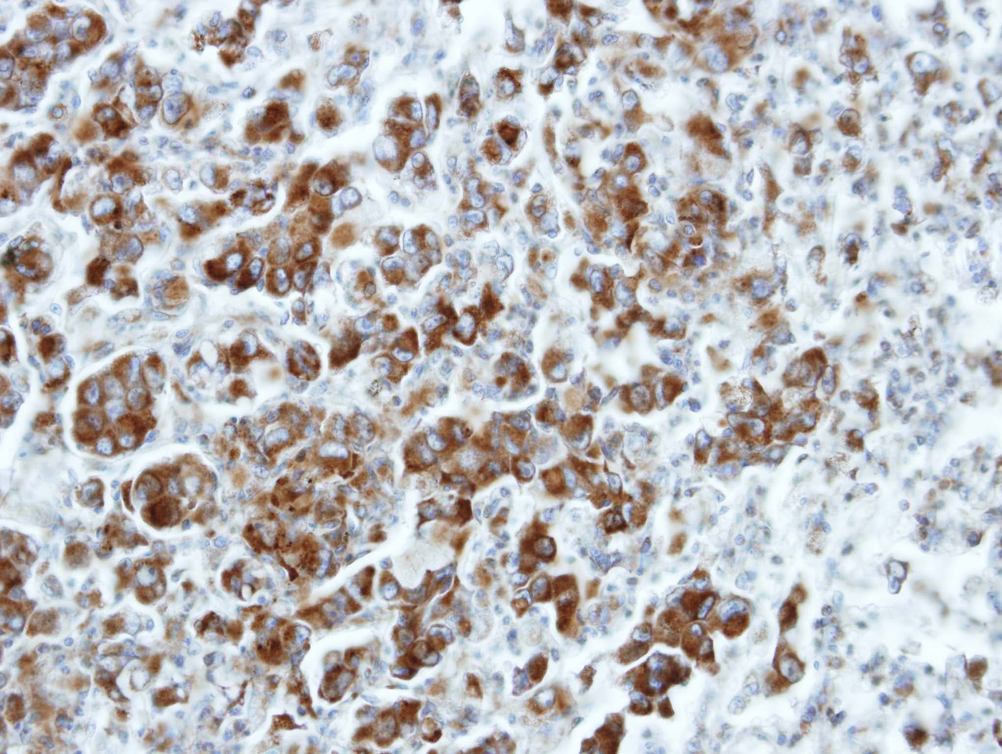 FAF2 / ETEA Antibody (aa383-445)