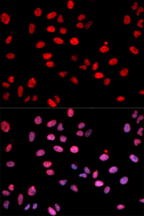 Polyclonal Rabbit anti-Human JUN / c-Jun Antibody (phospho-Ser243, IF, WB)
