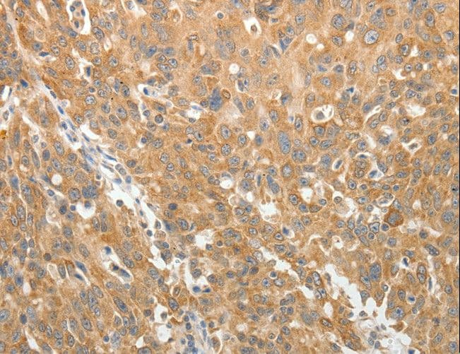 AKR1B1 / Aldose Reductase Antibody