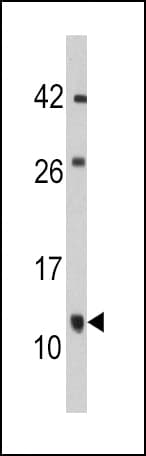 FKBP1B / FKBP12.6 Antibody (aa1-30)