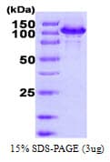 Human HSPH1 / HSP105 Protein (Recombinant His)
