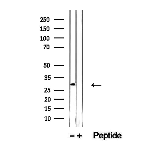 Polyclonal Rabbit anti-Human ETFA Antibody (IHC, IF, WB)