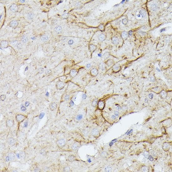 TBCA Antibody