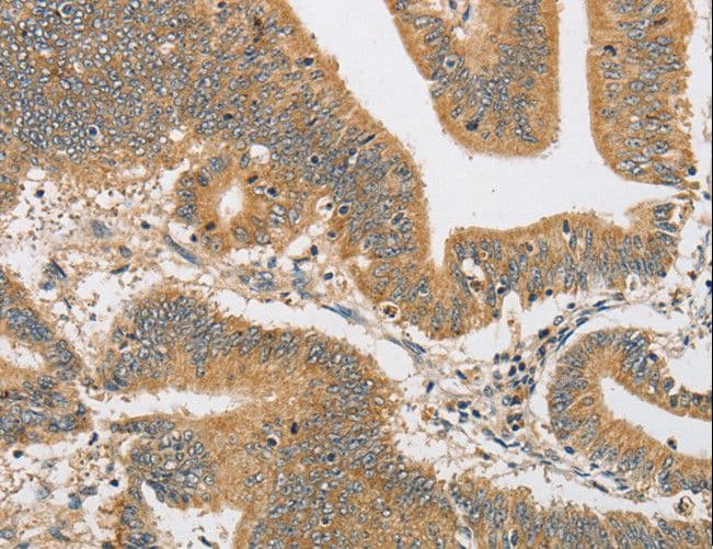 Polyclonal Rabbit anti-Human ARHGAP15 Antibody (IHC)