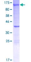 Human XPOT / Exportin-T Protein (Recombinant GST)