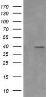 MAP2K3 / MEK3 / MKK3 Antibody (clone OTI5D7)