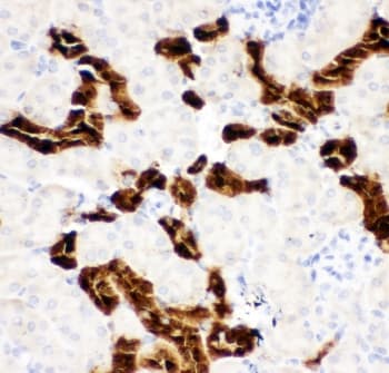 CALB1 / Calbindin Antibody (aa2-175)