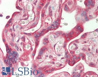 IHC-plus™ NFKBIA / IKB Alpha / IKBA Antibody (aa9-58)