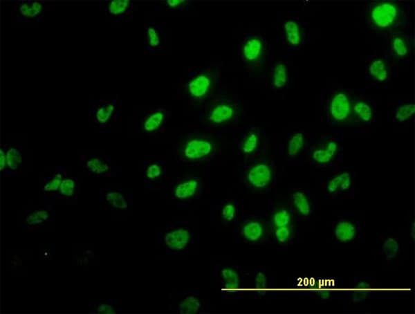 Monoclonal Mouse anti-Human TRIM36 Antibody (clone 2D11, IHC, IF, WB)