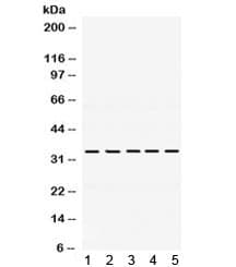 TIMP3 Antibody