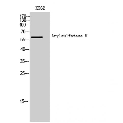 ARSK / Arylsulfatase K Antibody (450-530 aa, C-terminal)