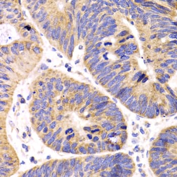 HMGCL Antibody