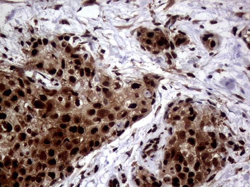 Monoclonal Mouse anti-Human TALDO1 / Transaldolase 1 Antibody (clone OTI1A5, IHC, WB)