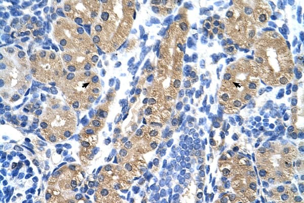 HSD17 / HSD17B1 Antibody (N-Terminus)