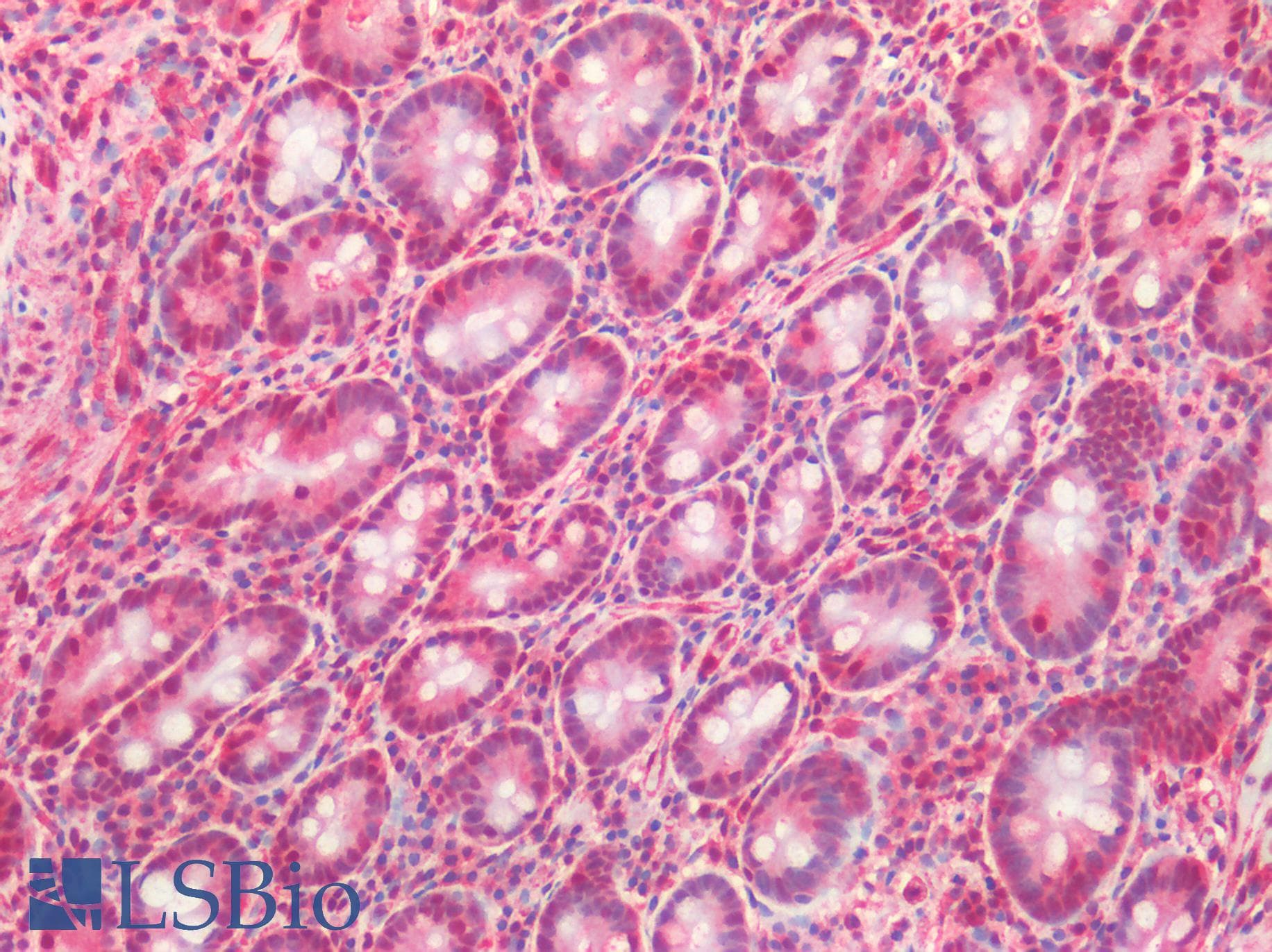 PathPlus™ Polyclonal Rabbit anti-Mouse MRE11A / MRE11 Antibody (IHC, WB)