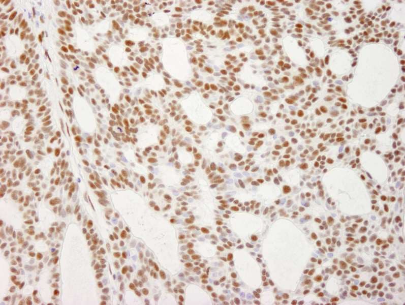 RECQ1 / RECQL Antibody (aa600-C-term)