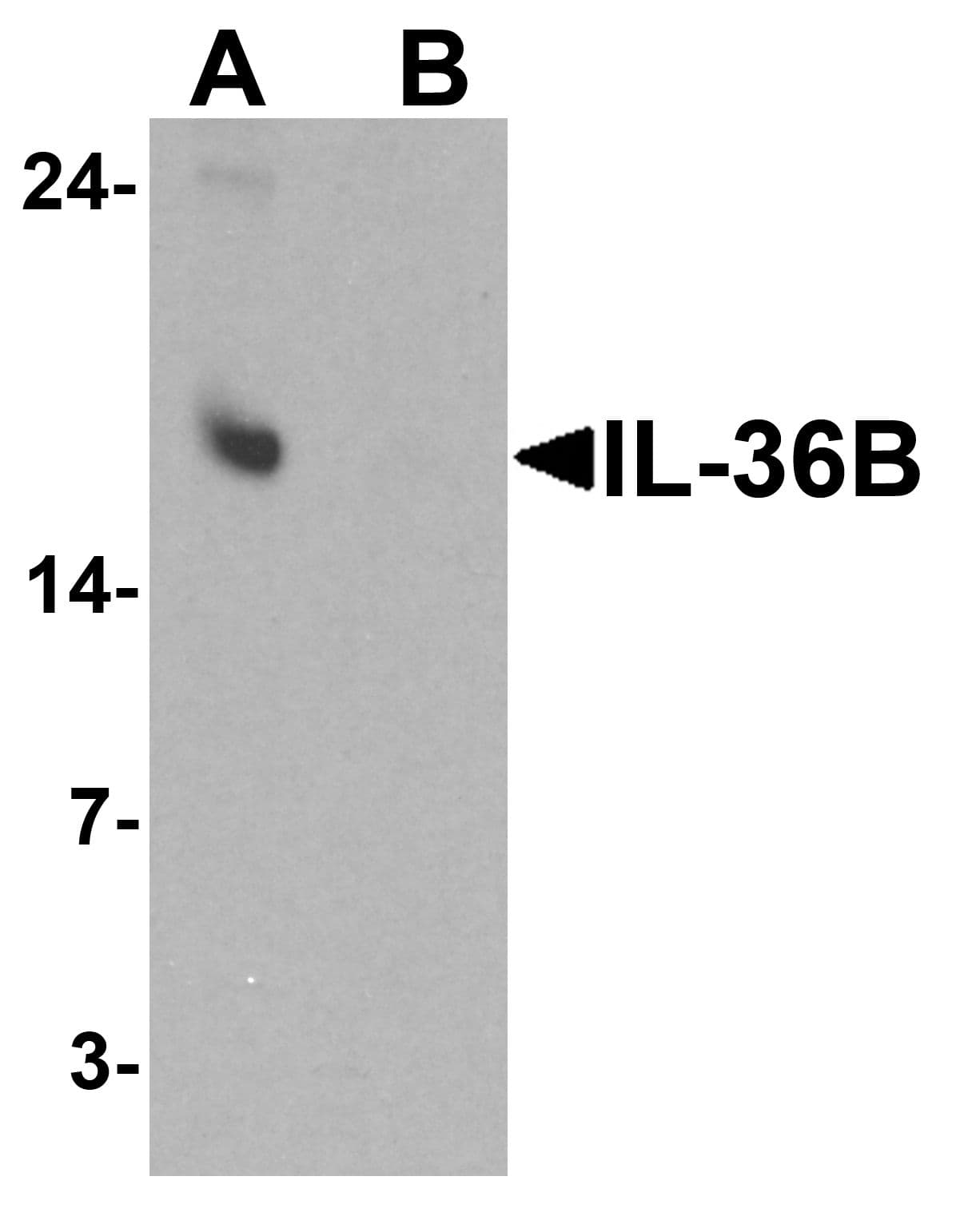 IHC-plus™ IL36B Antibody