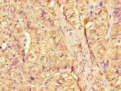 CTSA / Cathepsin A Antibody