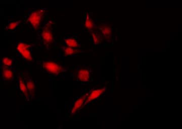 NF2 / Merlin Antibody