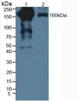 PZP Antibody (aa1212-1391)