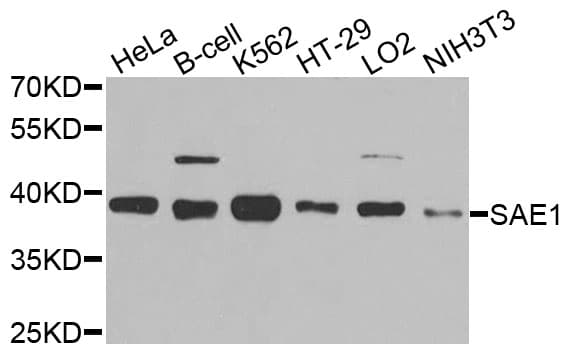 SAE1 Antibody