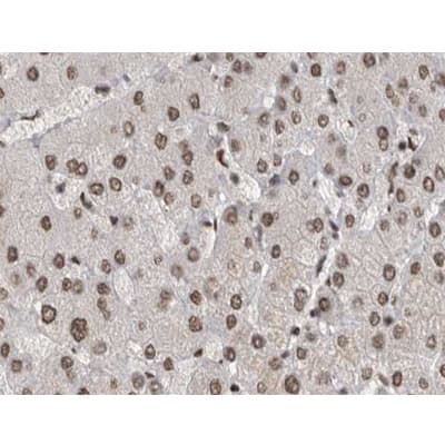 Polyclonal Rabbit anti-Human MAPK8 / JNK1 Antibody (phospho-Tyr185, IHC, IF, WB)