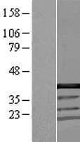 CCDC94 Protein (Over-Expression Lysate Myc-DDK (Flag))