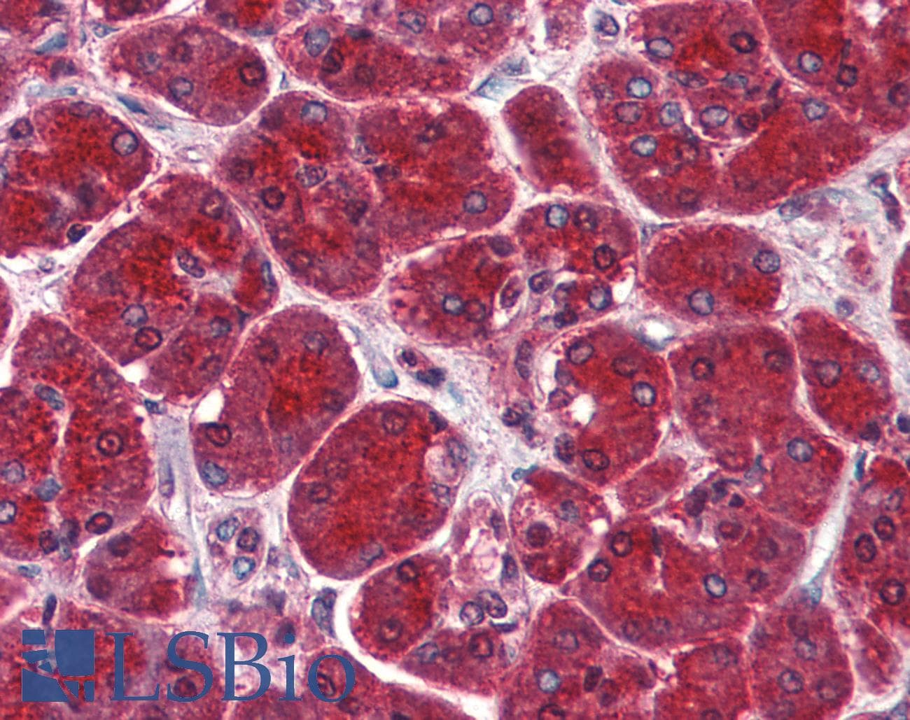 IHC-plus™ SUGP2 / SFRS14 Antibody