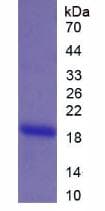 Rat MGP / Matrix Gla-Protein (Recombinant His-S)