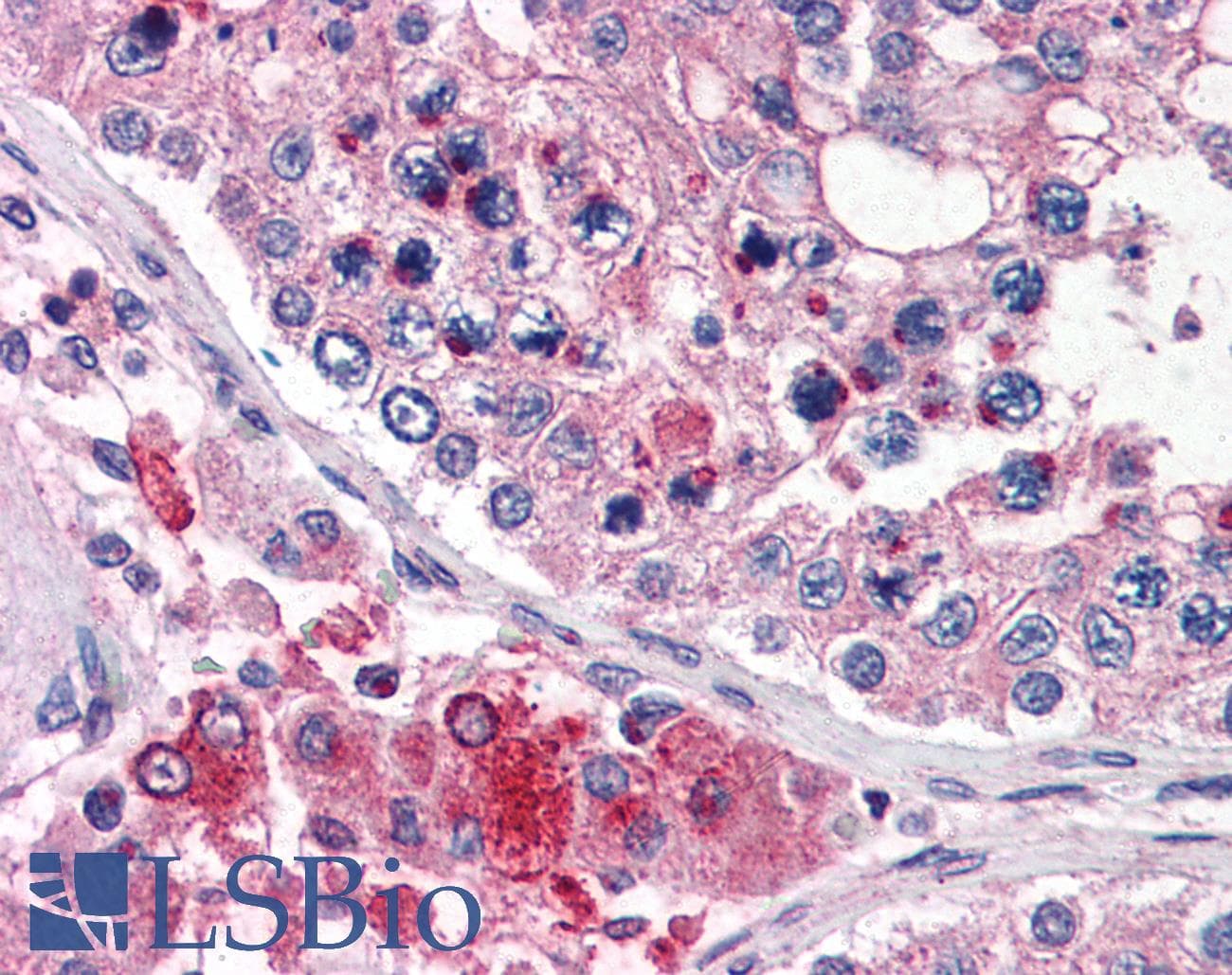IHC-plus™ TMC6 Antibody