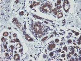 MAPK9 / JNK2 Antibody (clone OTI2H3)
