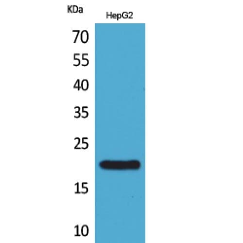 Polyclonal Rabbit anti-Human DUSP3 / VHR Antibody (C-terminal, WB)