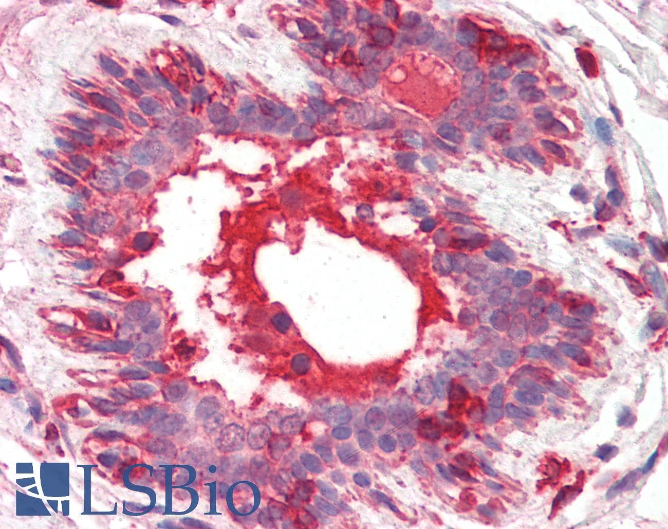 PathPlus™ HGF / Hepatocyte Growth Factor Antibody (clone 7-2)