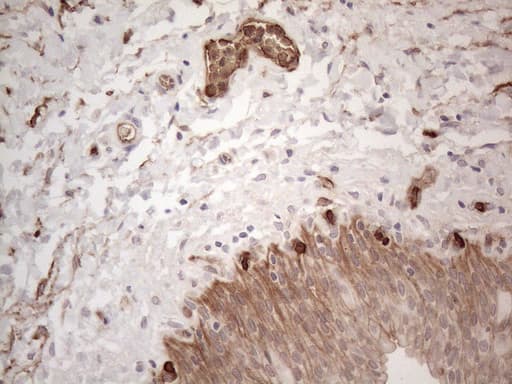 Monoclonal Mouse anti-Human PROCR / EPCR Antibody (clone OTI12H5, aa1-210, IHC, WB)