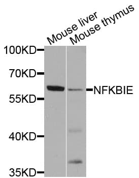 Polyclonal Rabbit anti-Human NFKBIE / IKB Epsilon Antibody (WB)