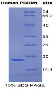 Human PBRM1 / BAF180 / PB1 Protein (Recombinant His)