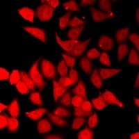 ERCC2 / XPD Antibody