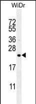 Polyclonal Rabbit anti-Human hCG_1657980 Antibody (aa 94-122, Internal, WB)
