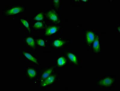 Polyclonal Rabbit anti-Human DDX42 Antibody (IHC)