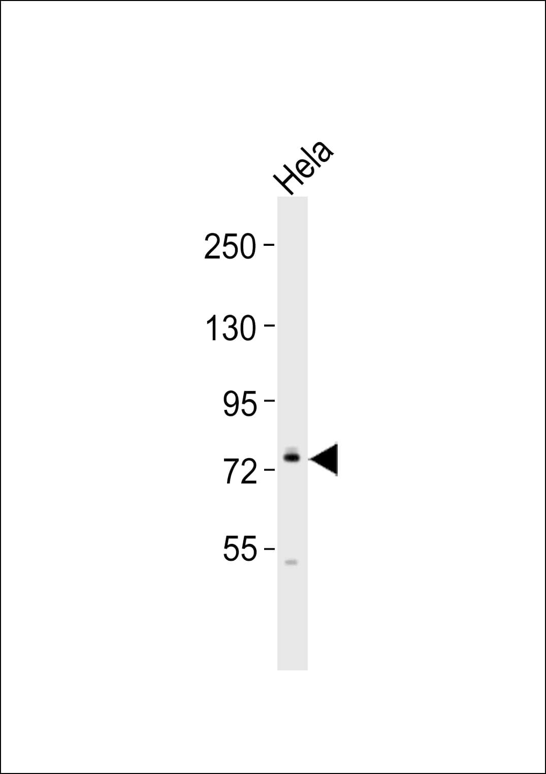 MASP2 / MASP-2 Antibody
