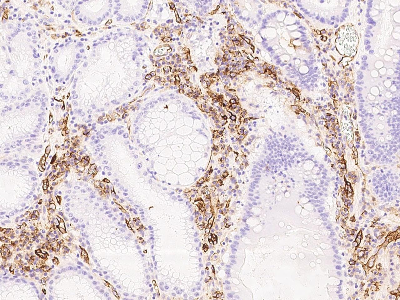 Polyclonal Rabbit anti-Human ICAM-1 / CD54 Antibody (Preservative Free, IHC, IF)