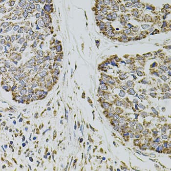 SELP / P-Selectin / CD62P Antibody